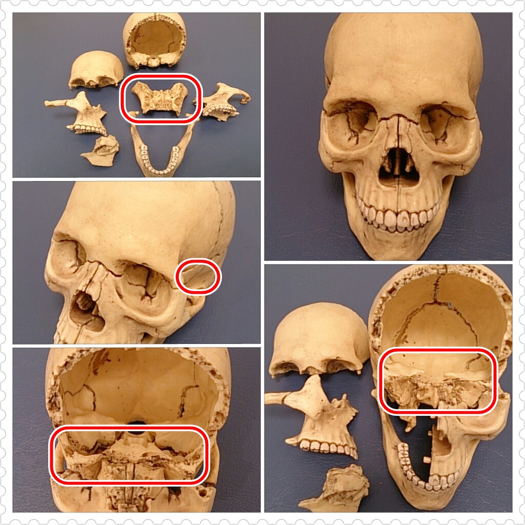頭蓋骨模型 蝶形骨