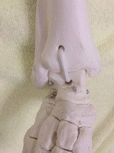 足関節模型(2)